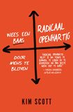 Radicaal openhartig (e-book)
